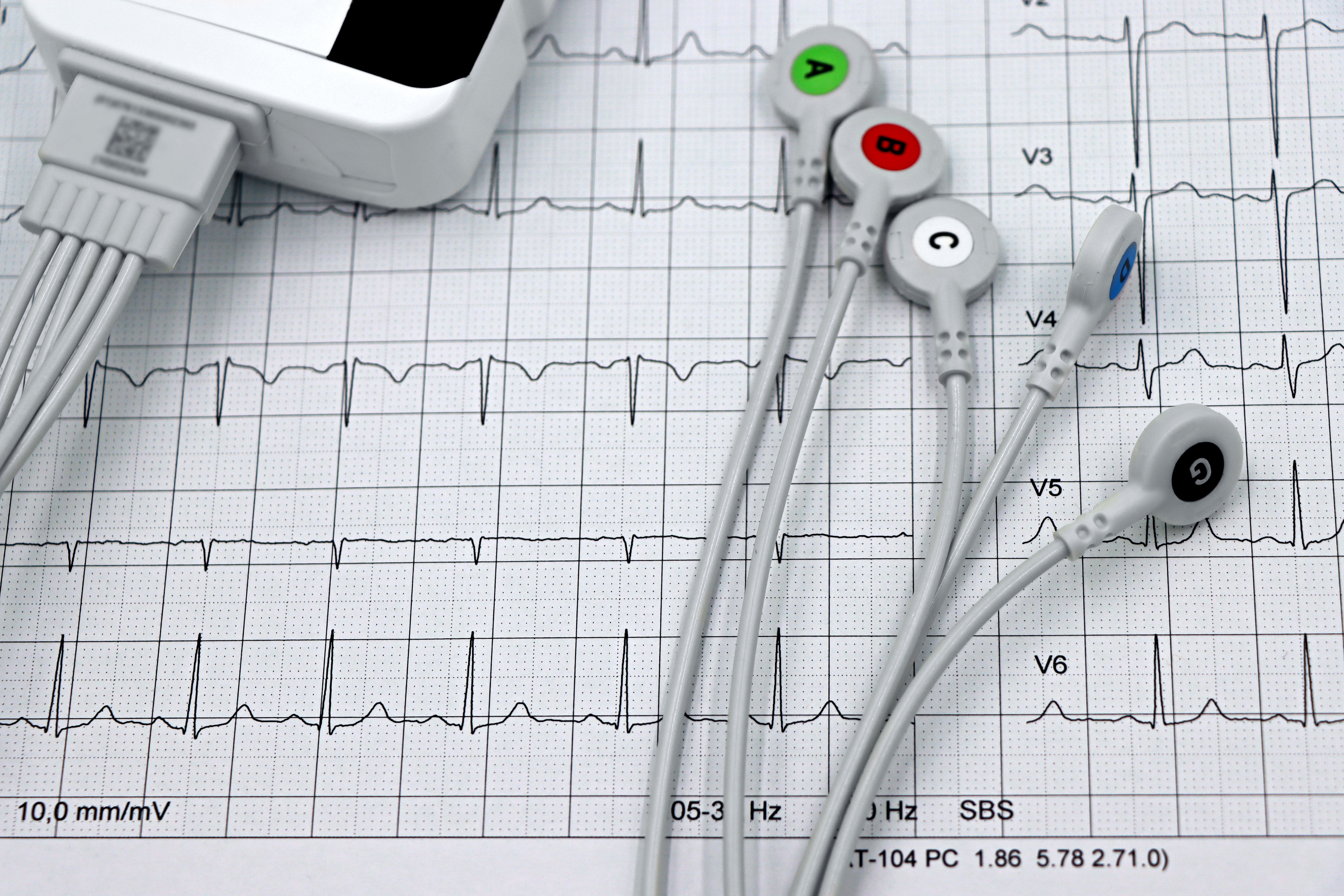 Global ECG Equipment Market: Industry Analysis and Forecast