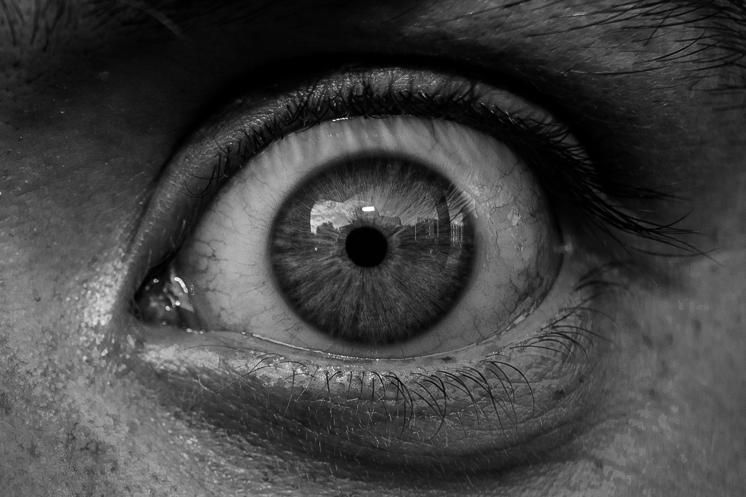 Acute Ocular Pain Market Size, Share and Future Growth