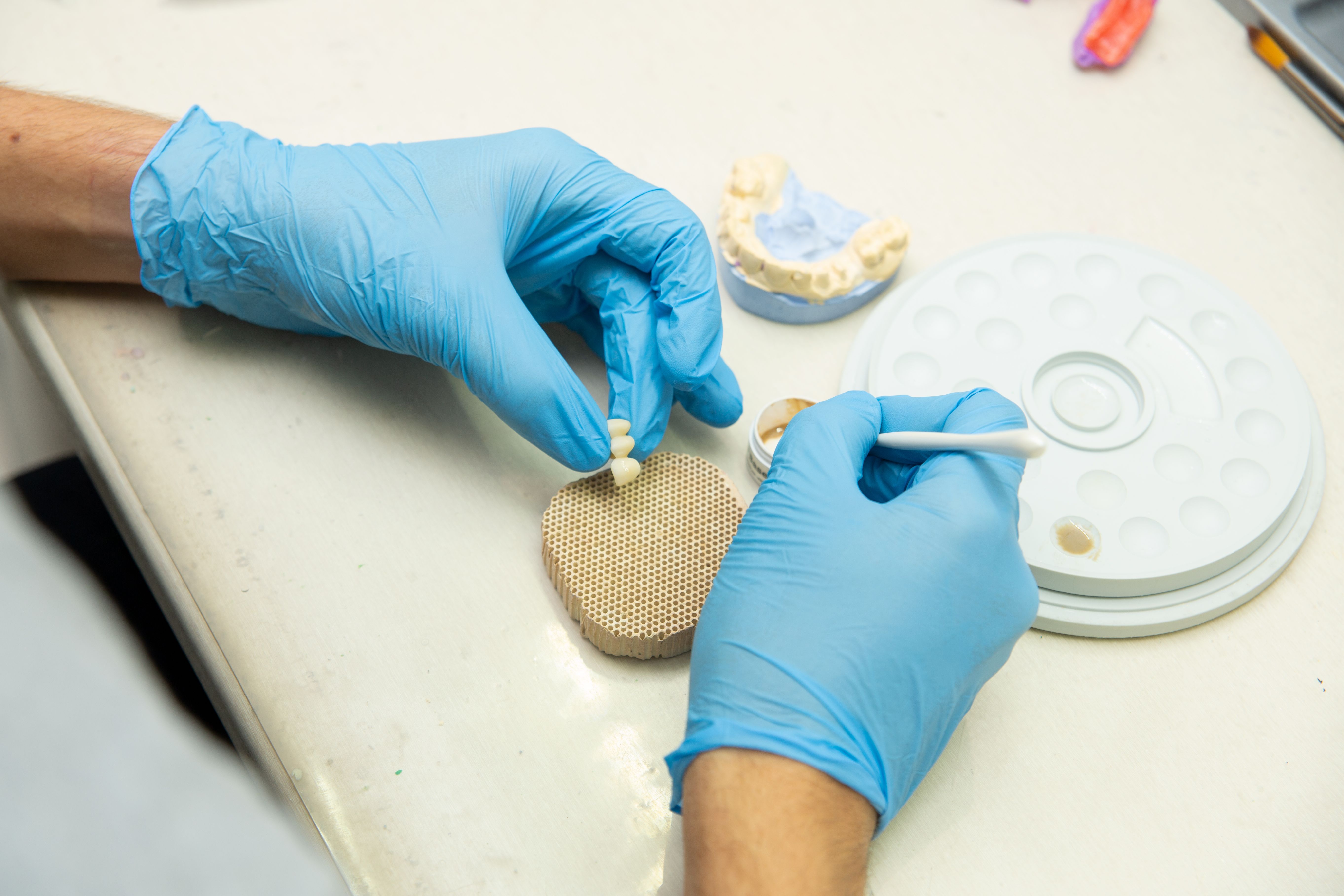 Dental Laboratory Workstations Market Size, Share & Trends