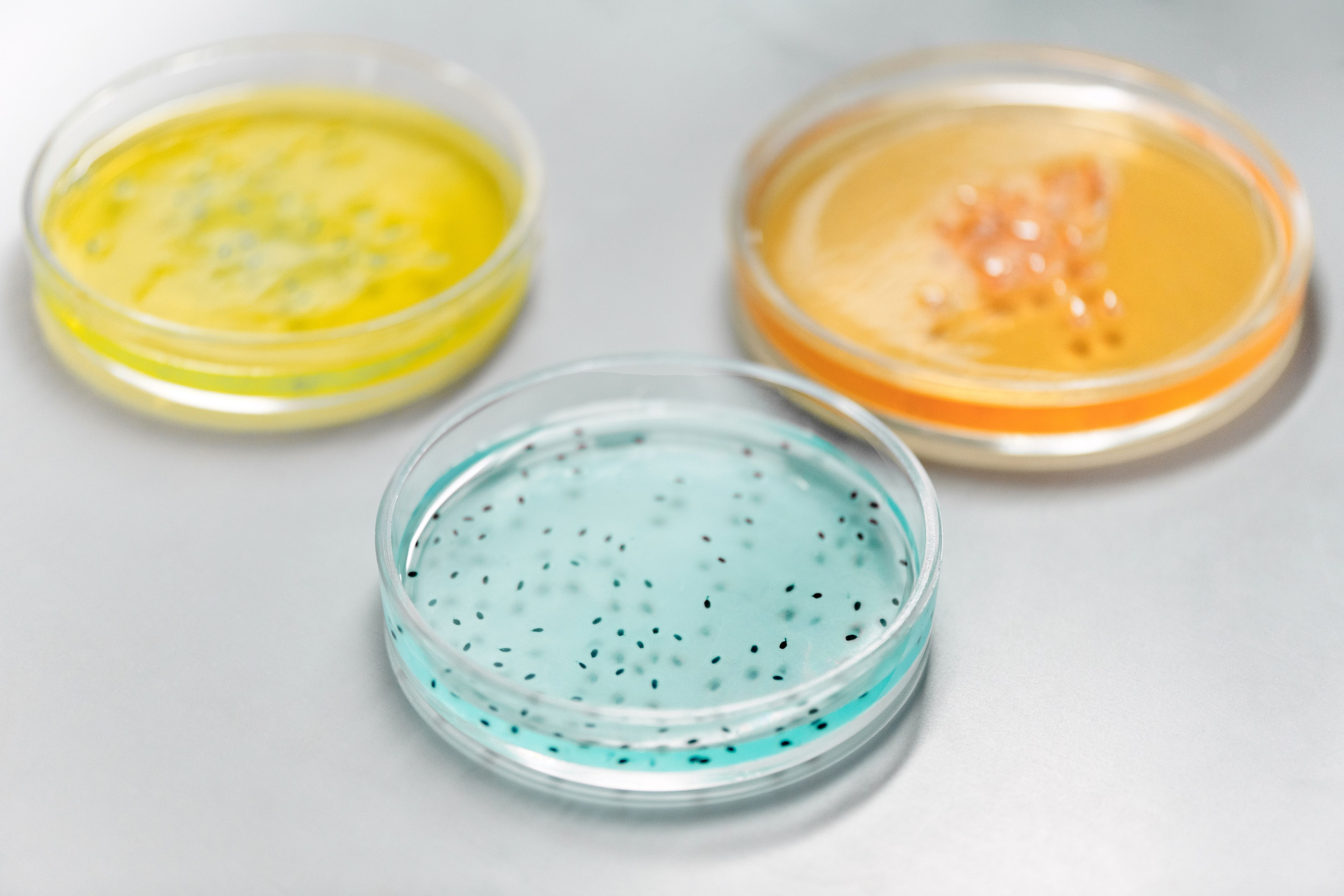 Agar Resin Market Size, Forecast Report to 2035