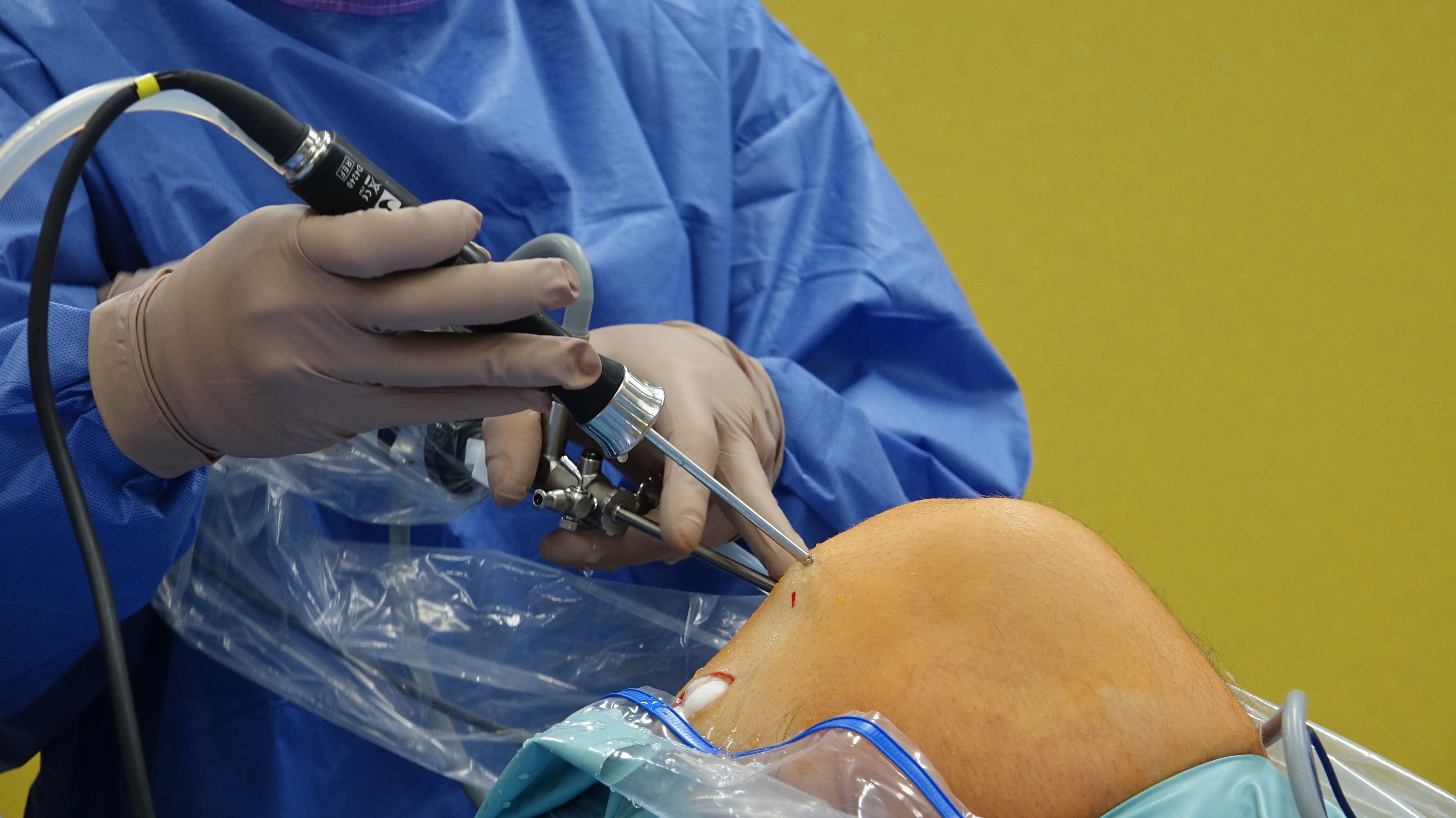 Cystoscopes Market 2035: Emerging Technologies & Opportunities