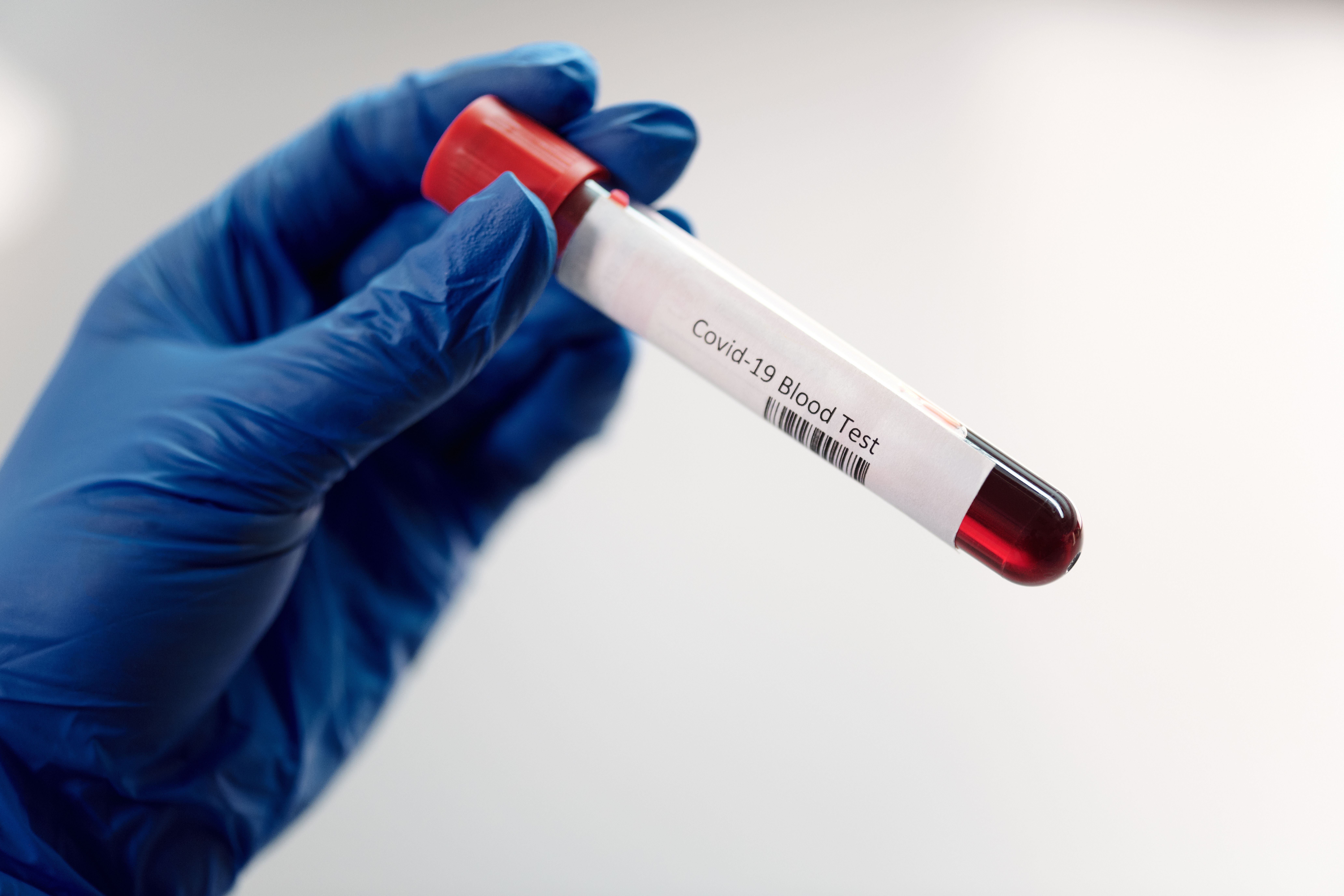 Latent Tuberculosis Detection Market 2035: Innovation in Diagnostic Testing