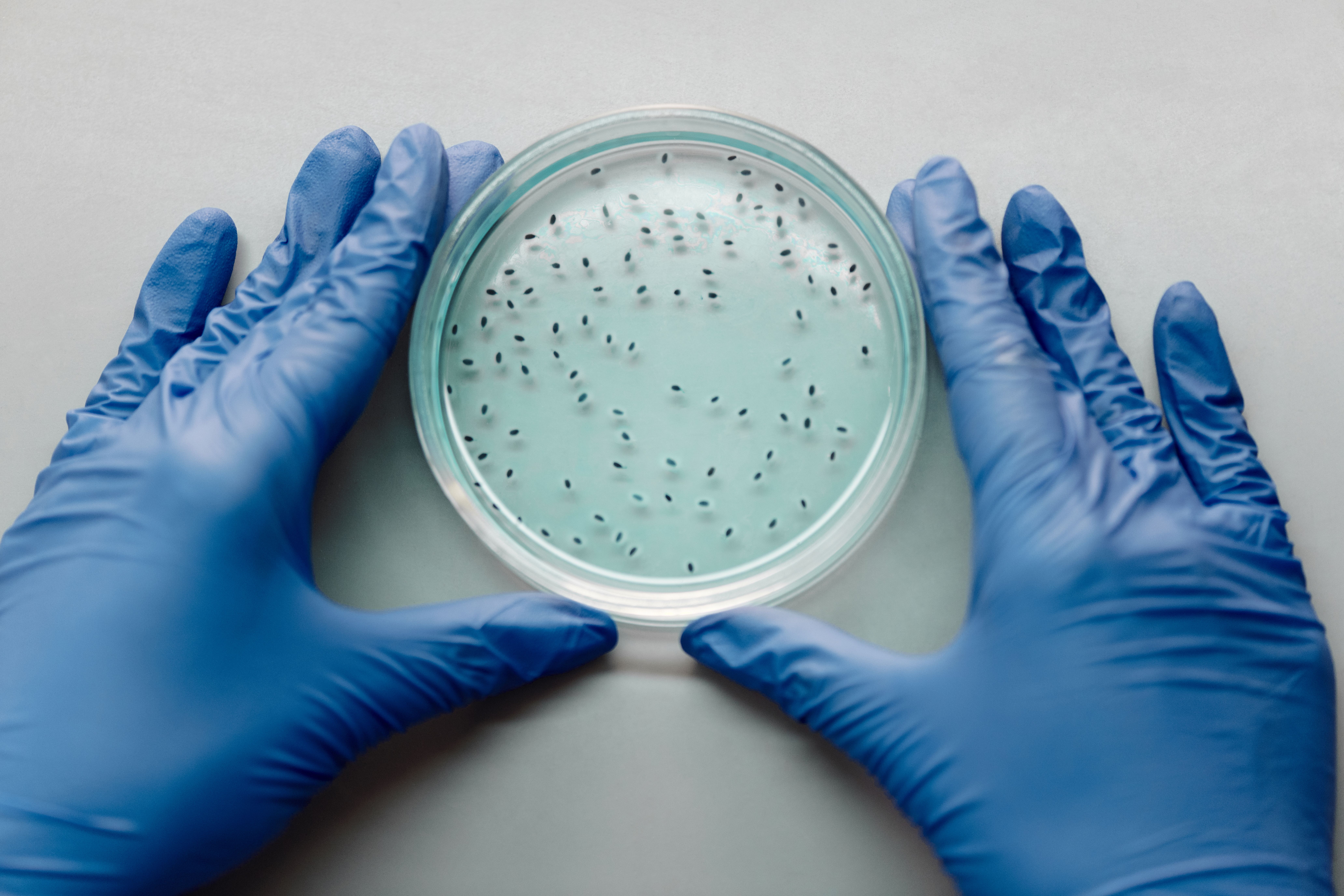 Microbial Cultures Market Size, Research, Forecasts To 2033