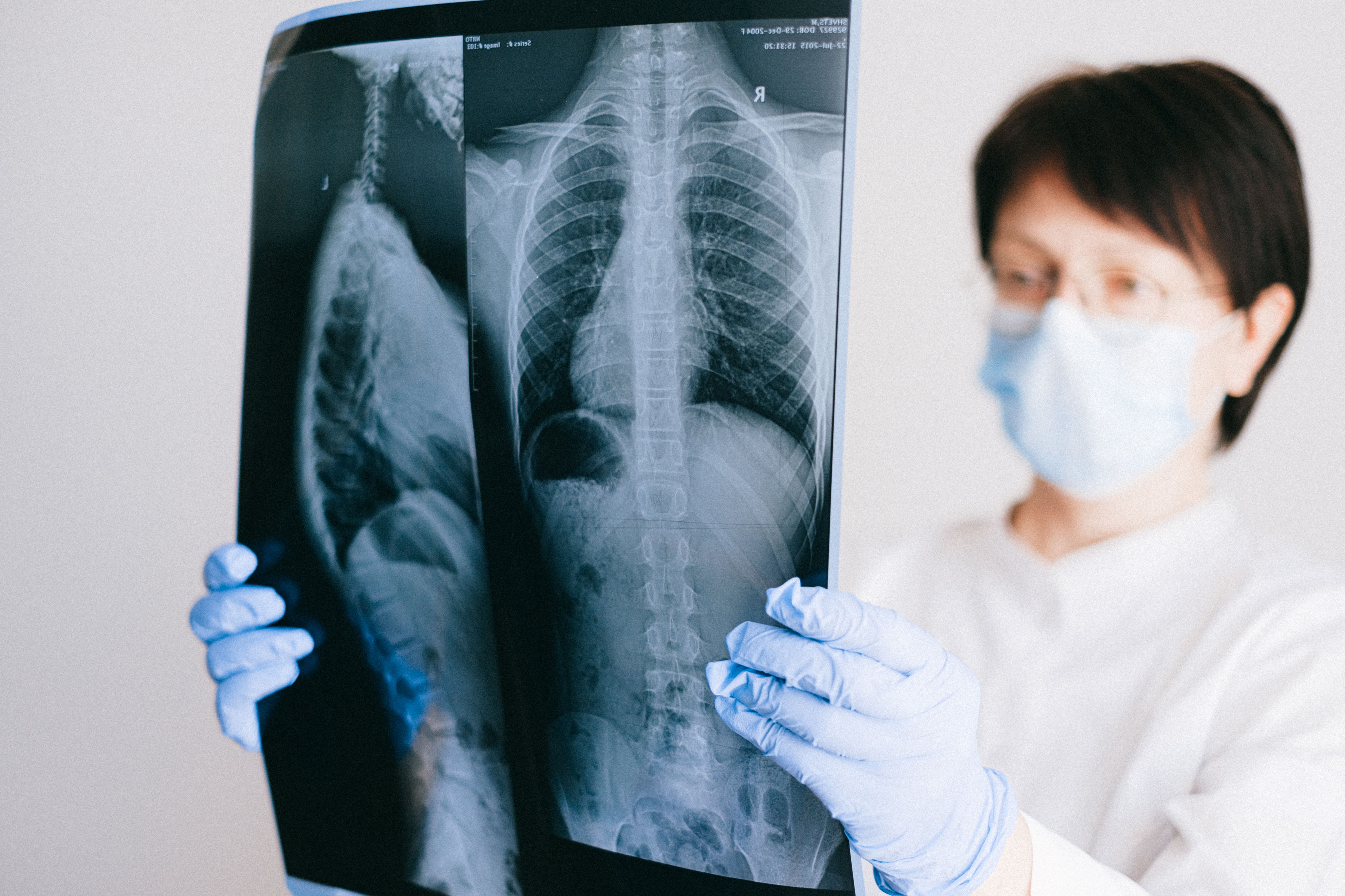 Myeloproliferative Disorders Market: Growth, Trends & Forecast to 2035