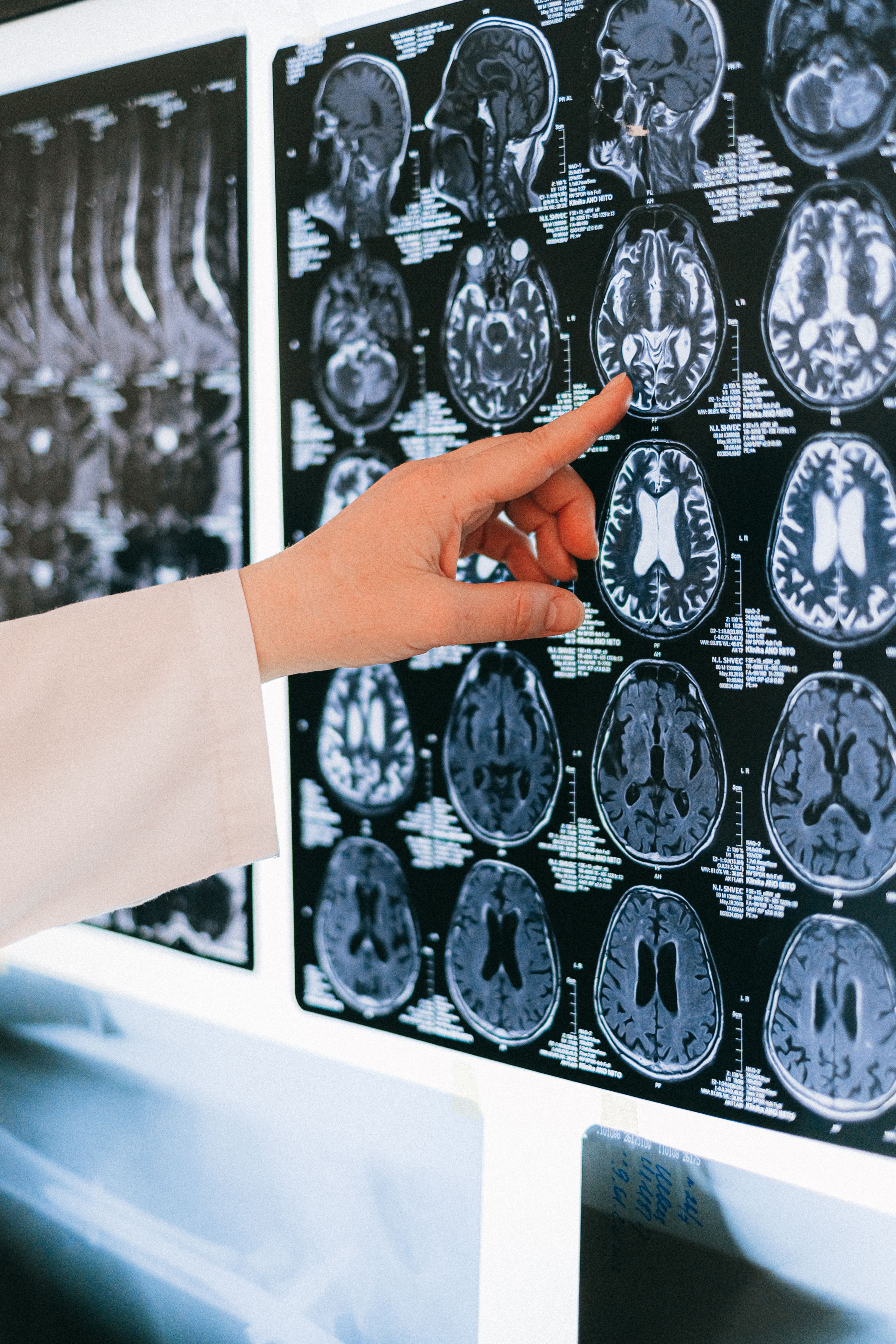 Preclinical Imaging Market Size, Demand to 2035