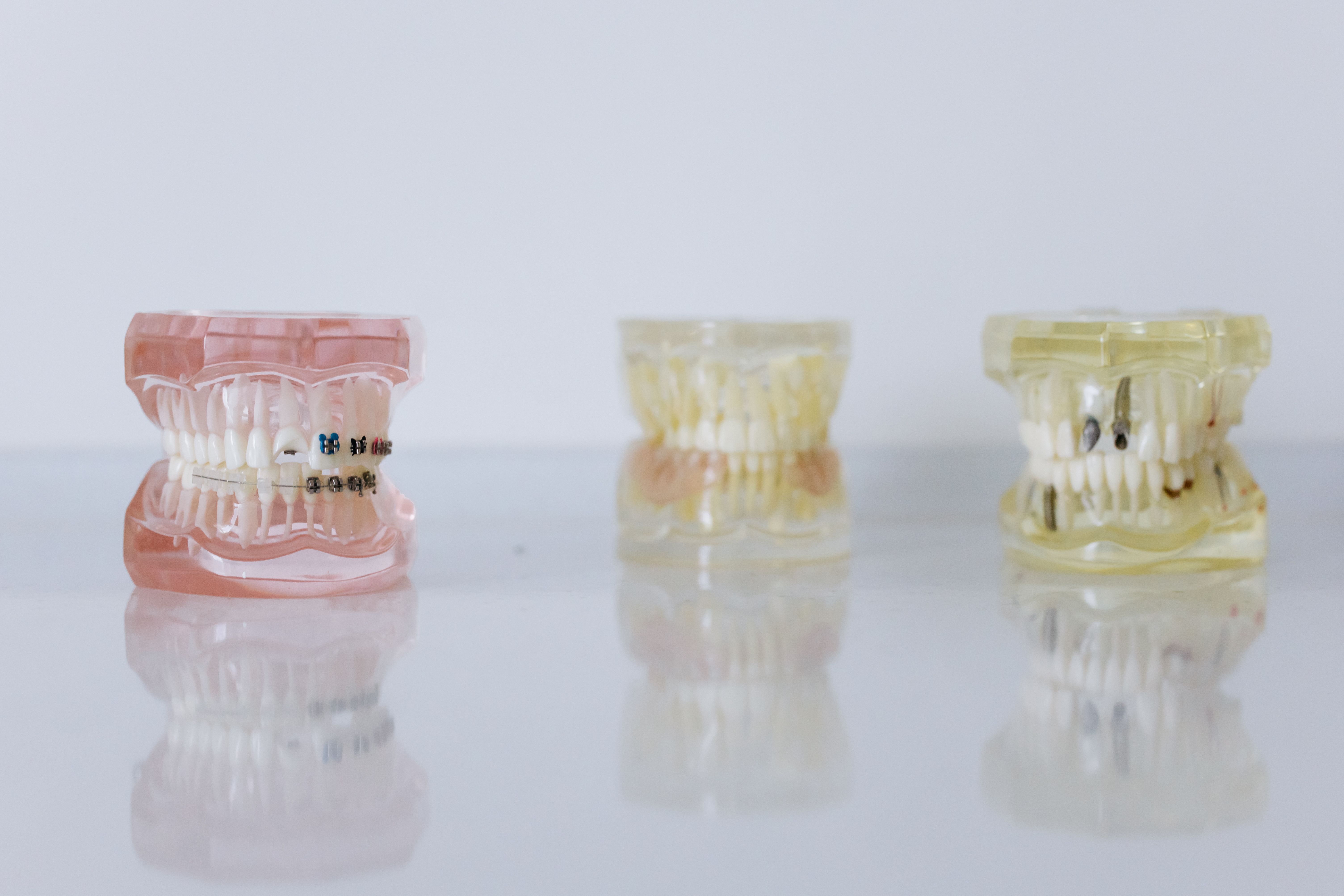 Global Medical Orthodontic Market: Industry Analysis and Forecast