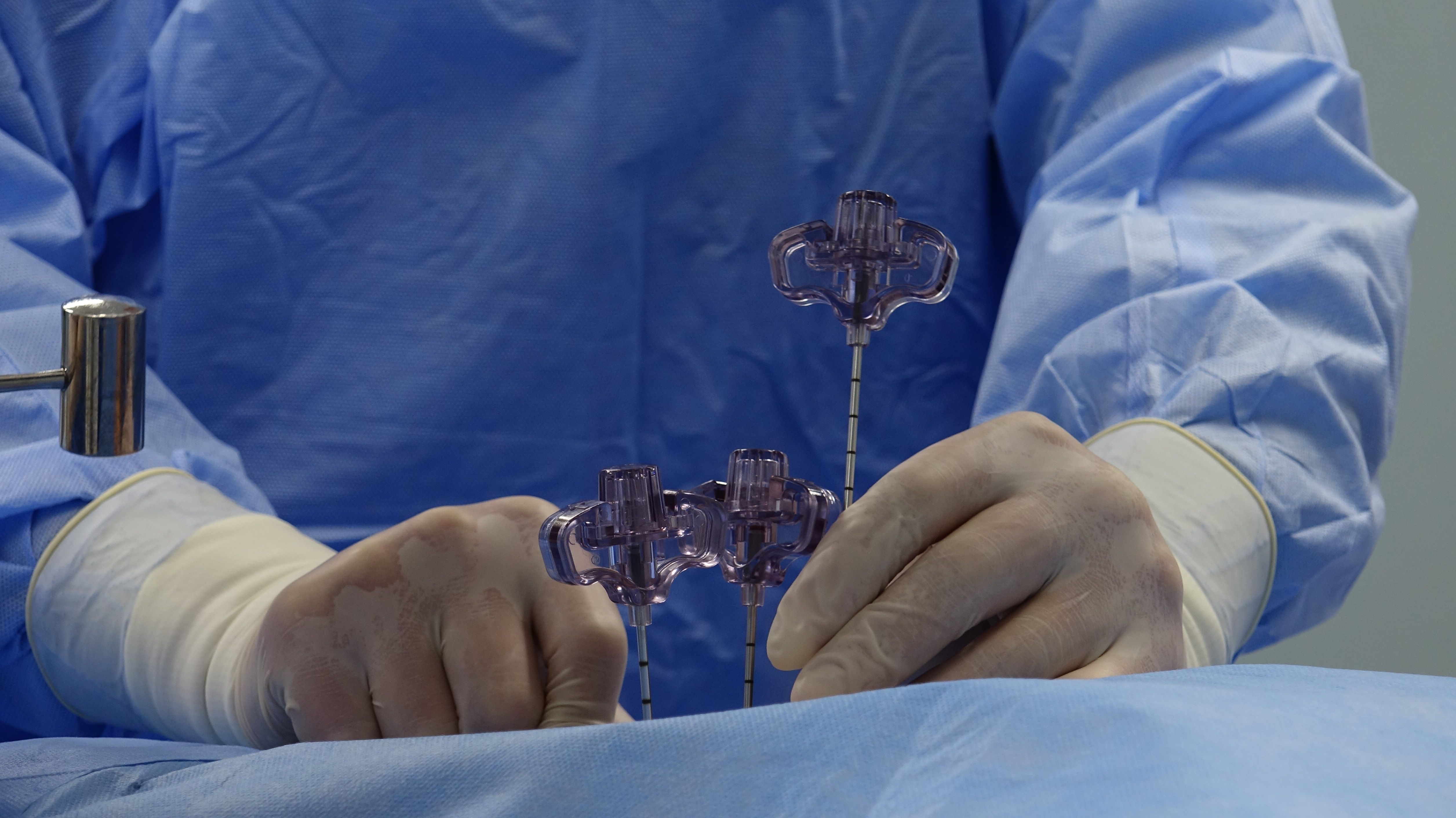 Microcatheters Market: How Medical Innovation Is Driving Market Expansion