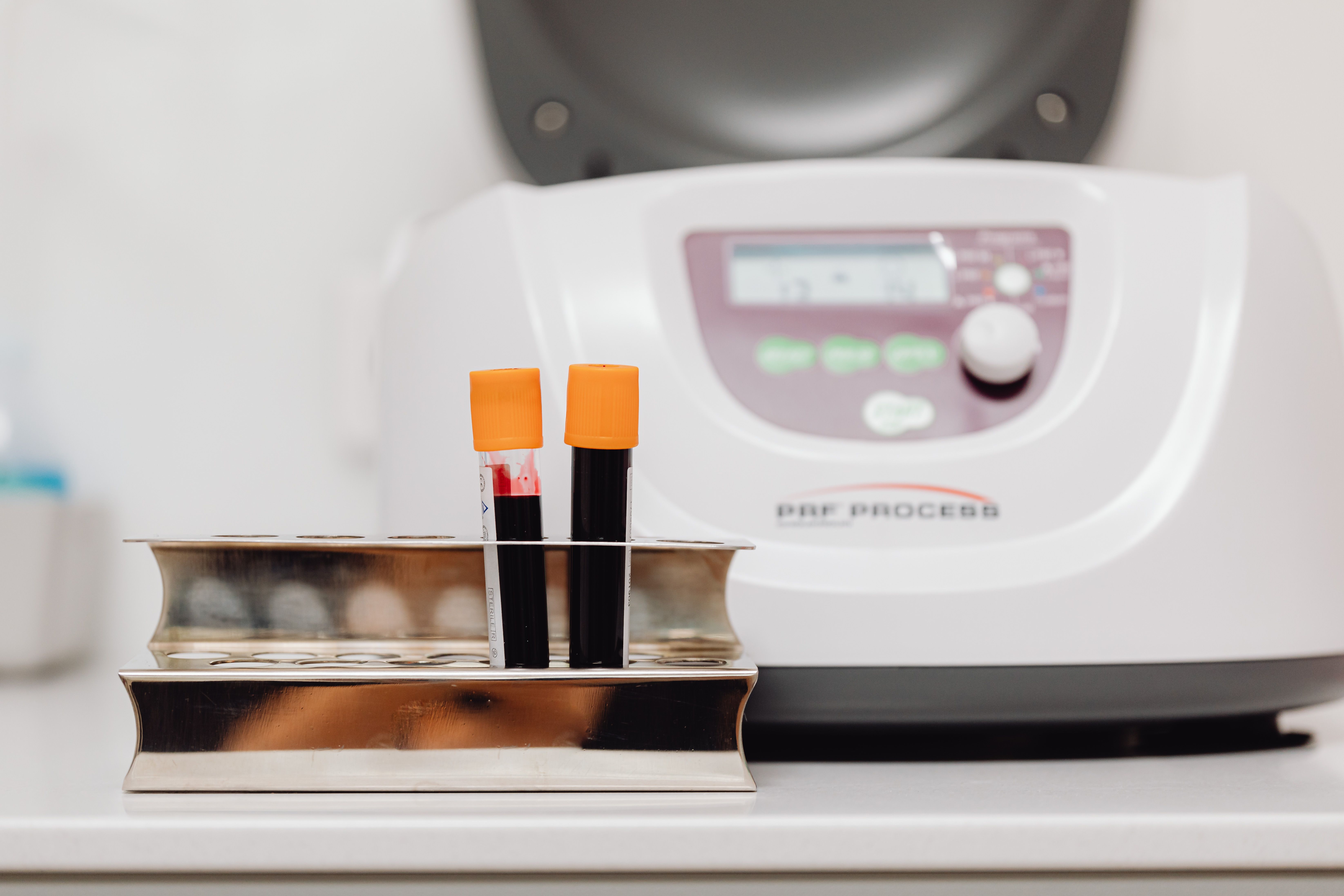 Fibrinogen Testing Market Poised for Growth | Forecast to 2035