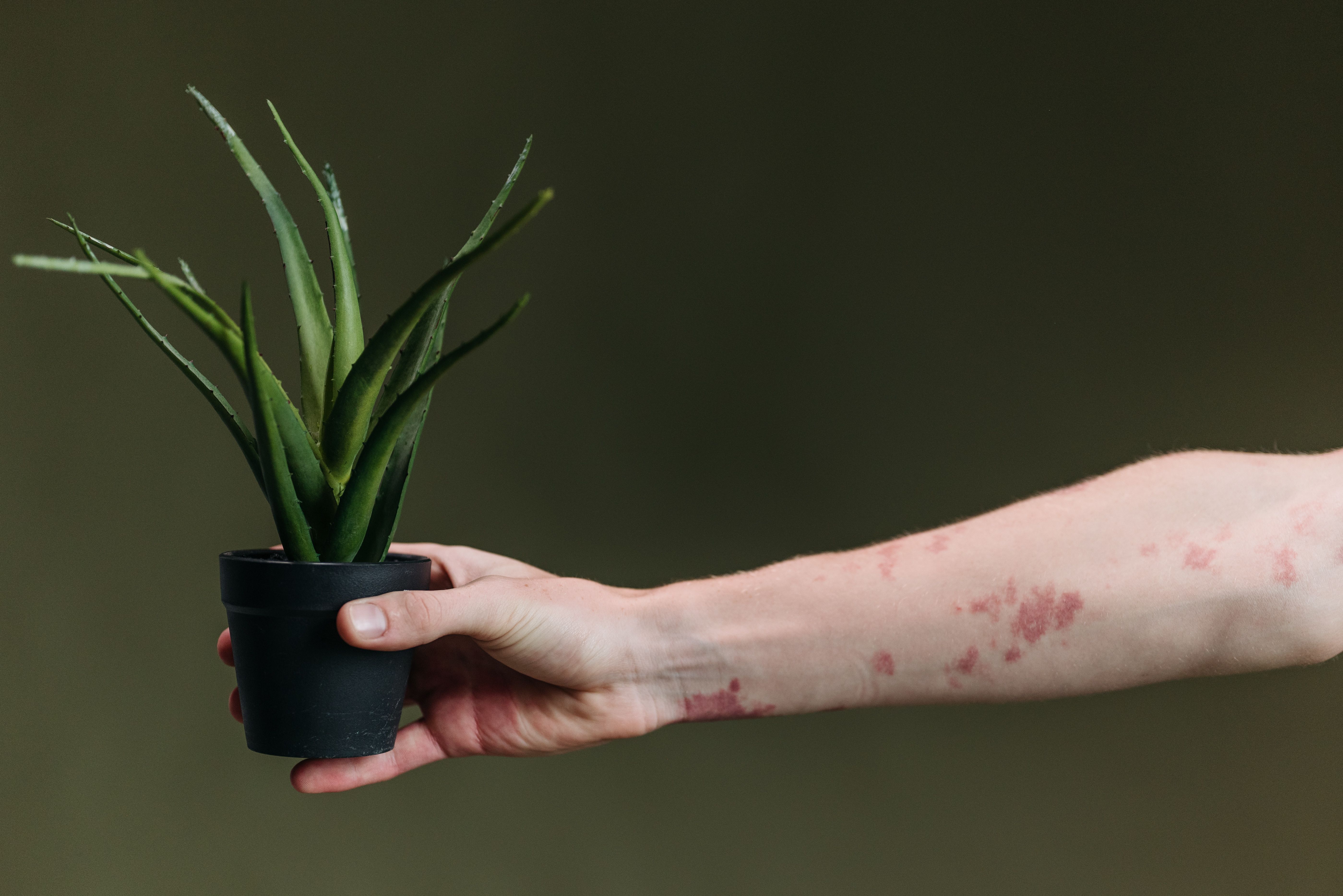 Pruritus Market Forecast of 2035