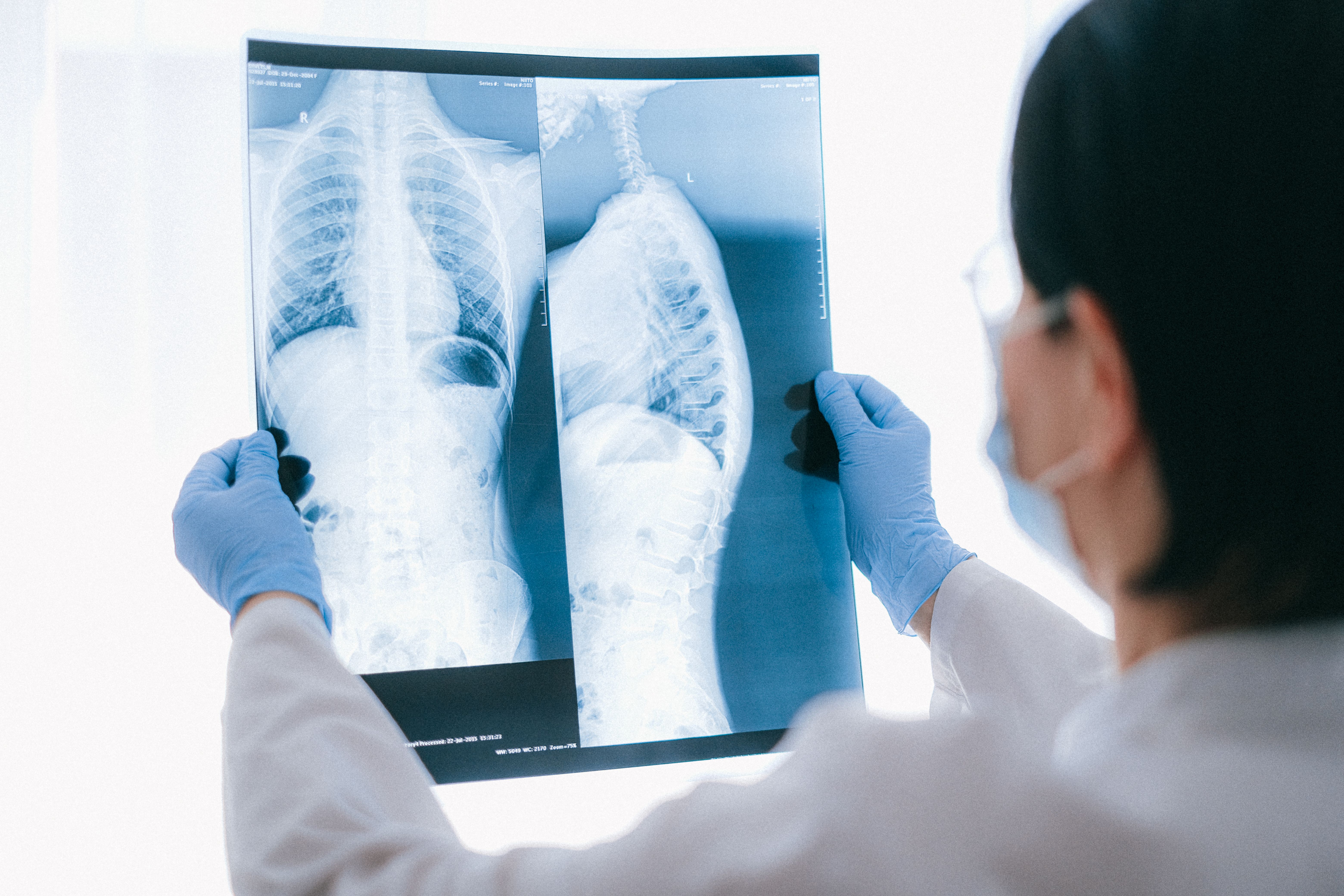 Global Artificial Lung Market Size, Insights, Forecasts to 2035