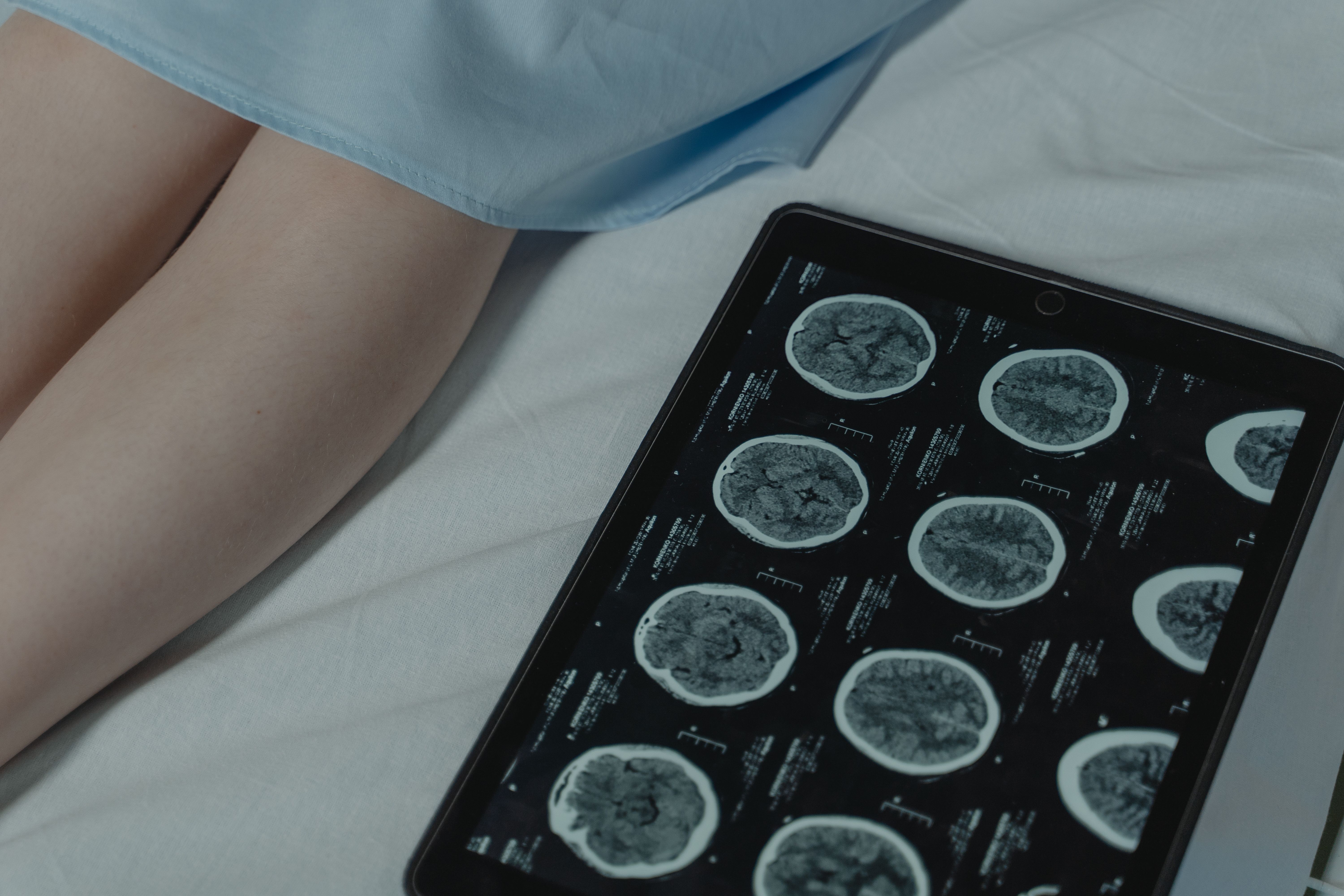 Photoacoustic Imaging Market Poised for Growth | Forecast to 2035